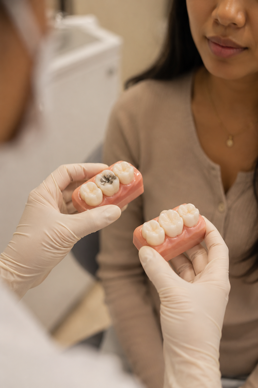 amalgam-vs-ceramic-filling amalgam-vs-ceramic-filling