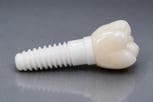 ceramic-dental-implant