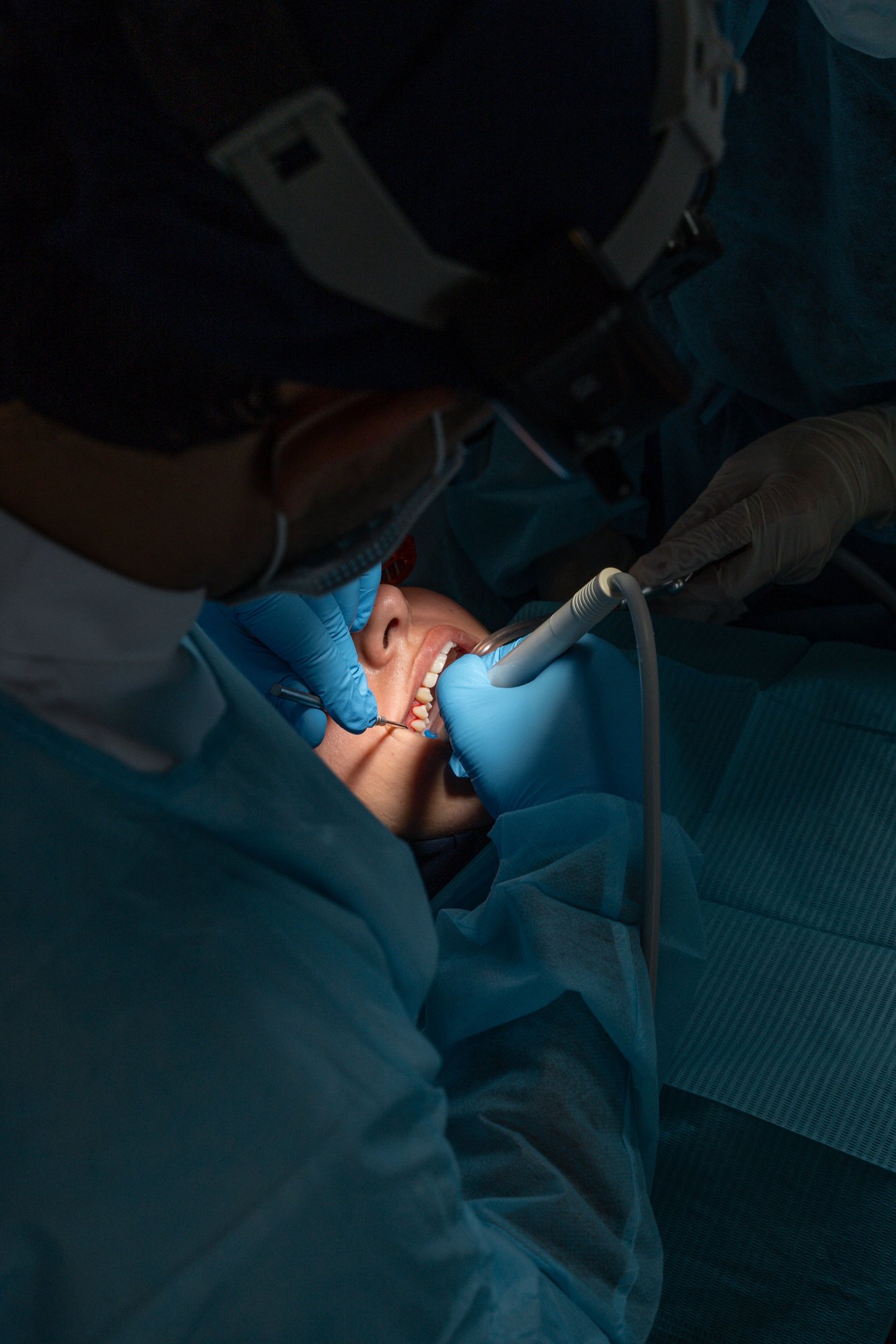 filling-removal