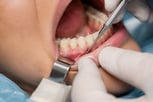periodontal-surgery